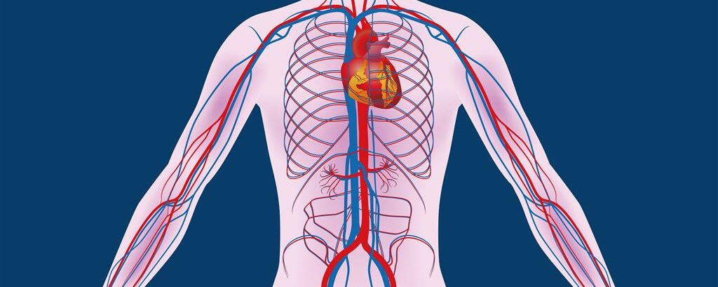 Aneurysma