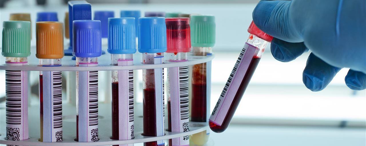 Bloed- of plasmadonor en sport