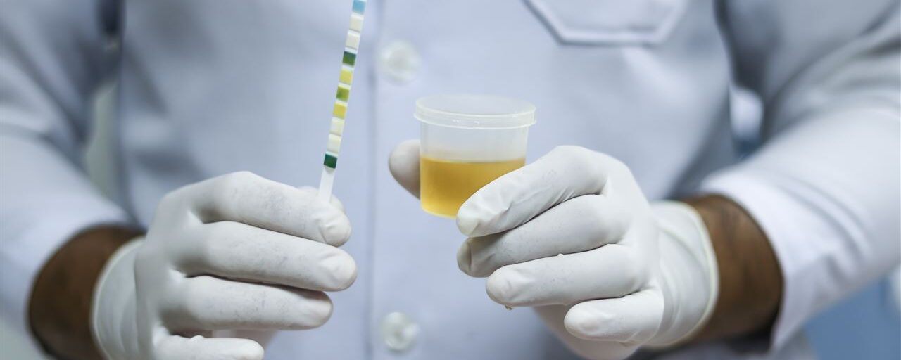 Drugstest urine