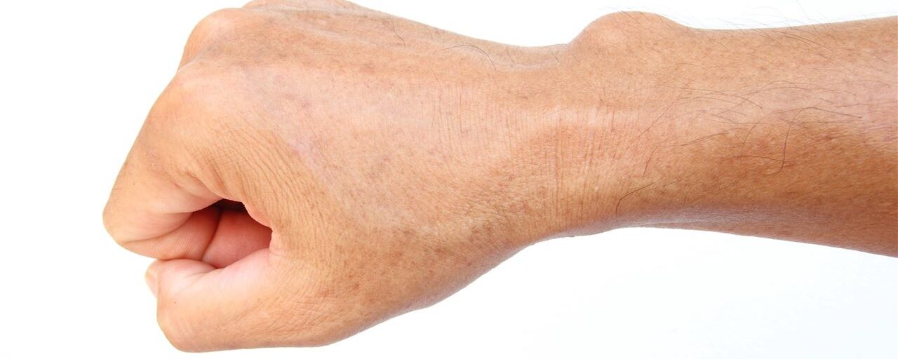 Ganglion