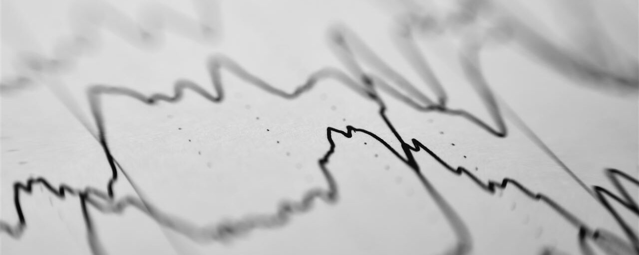 EEG